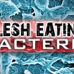 Fourth Case Of Flesh Eating Bacteria Confirmed In Mobile County   Flesh Eating Bacteria Florida 2017 Map
